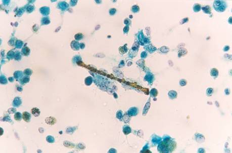 15F97AB5